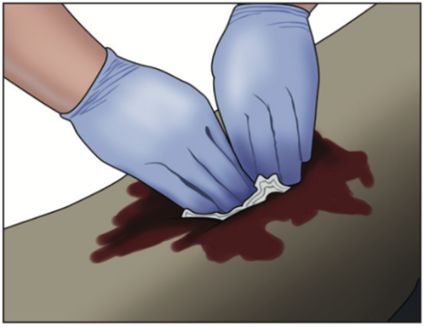 Two gloved hands applying pressure to a wound.