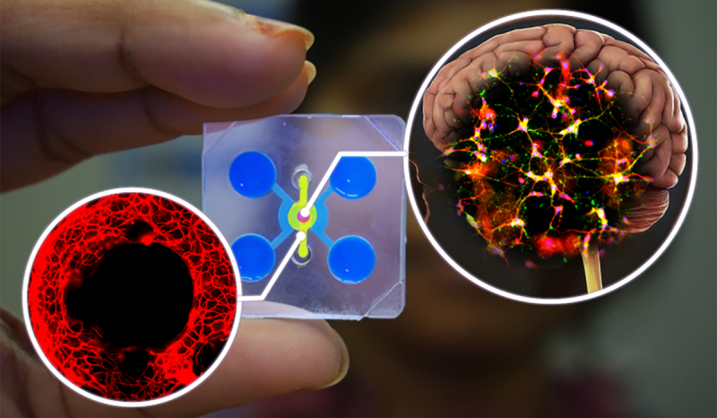 Brain-on-a-chip technology has neurons and blood vessels inside a microengineered device.