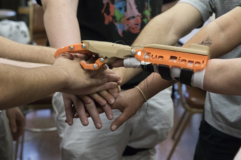 Perspective view of the prosthetic finger with individual