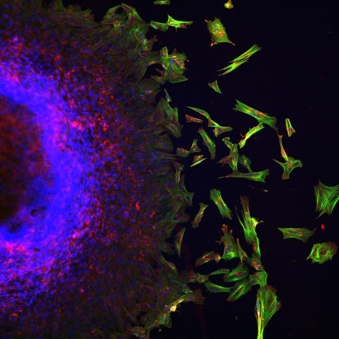 Migration into mesenchyme